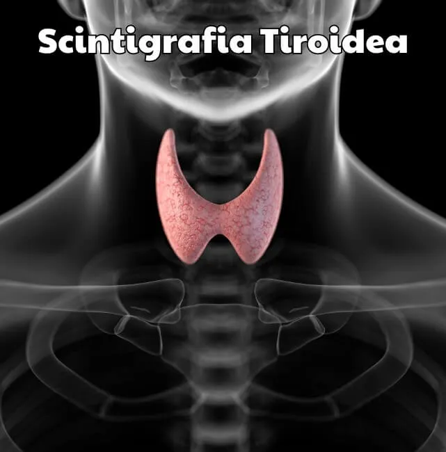 Scintigrafia Tiroidea - Esami Medici