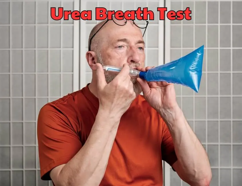 Urea Breath Test - Esami Medici